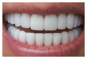 Cosmetic Dentistry 